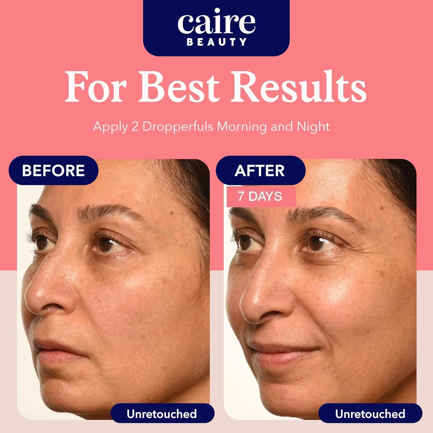 Caire ‘Own Your Age’ Bioavailable Hyaluronic Acid Collagen Peptide Serum for Face, Eyes + Neck | 15Ml