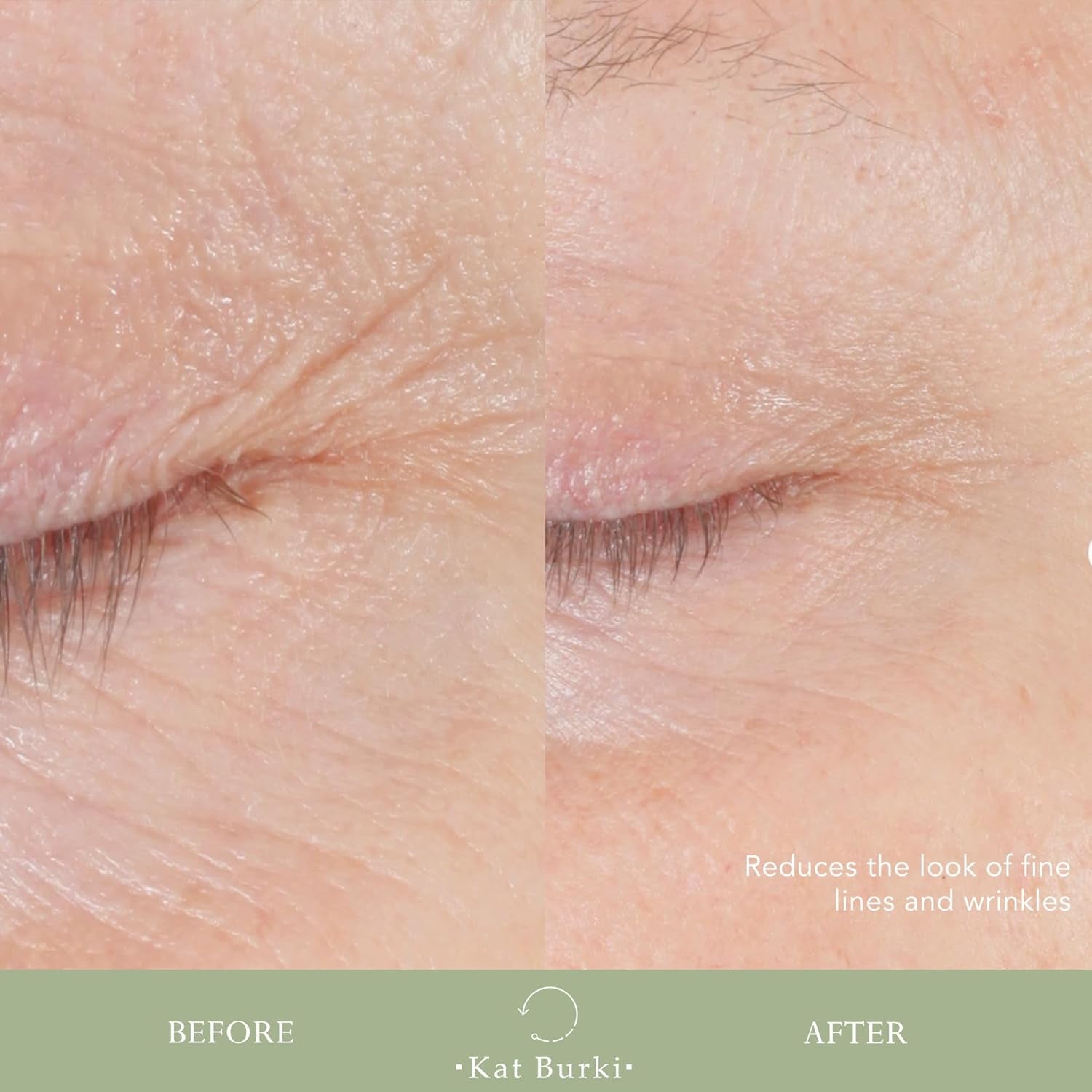 Kat Burki Form Control Marine Collagen Face Serum. Clinically Proven Anti-Aging Care Promoting Collagen Production: Lifts, Plumps & Contours Skin
